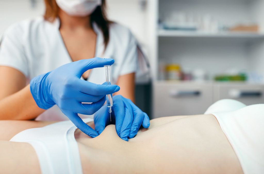 Liposuction to your Tummy Tuck